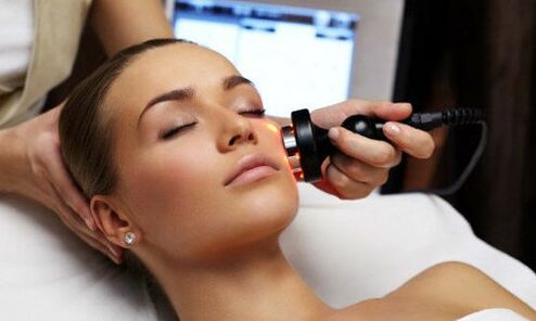 Laser rejuvenation